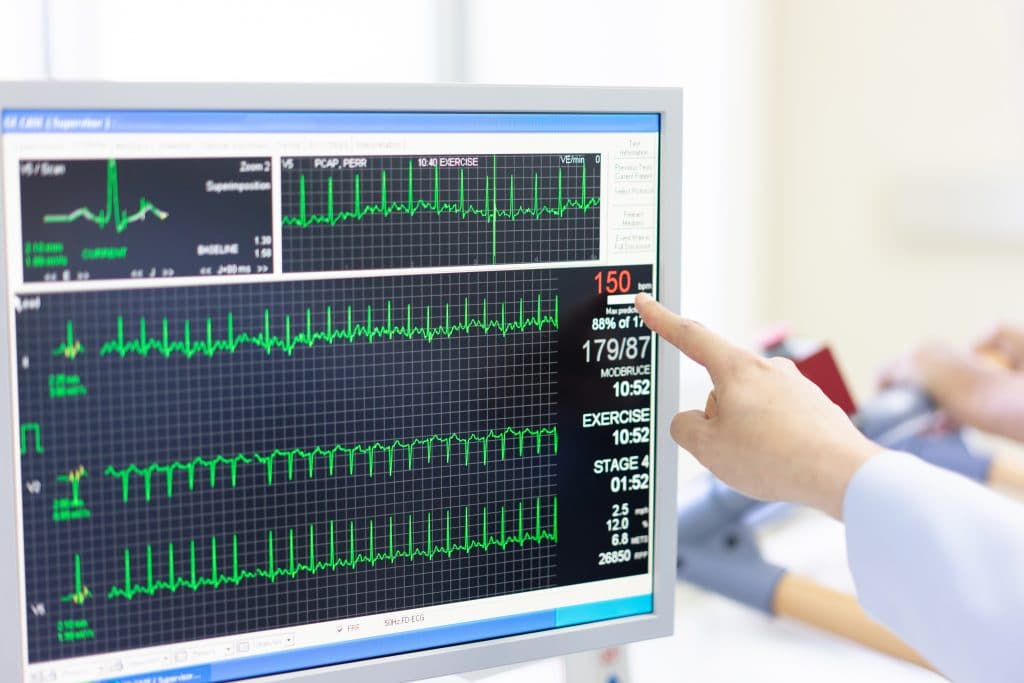 Монитор для контроля сердца на день. Фото монитора который устанавливает для проверки сердца. Проверка сердца оборудование экран. Accelerated Heart rate.