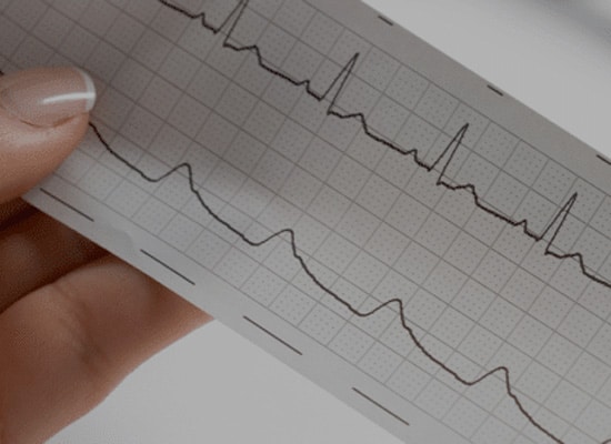 EKG: Electrocardiogram Technician